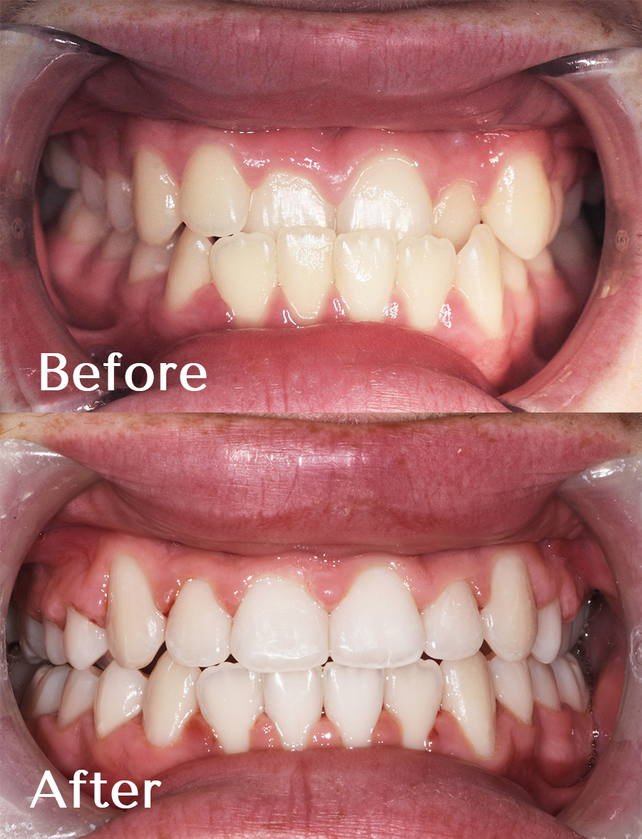 Smile Gallery Warrnambool Smile Dental