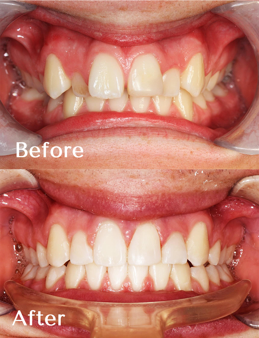 Smile Gallery Warrnambool Smile Dental