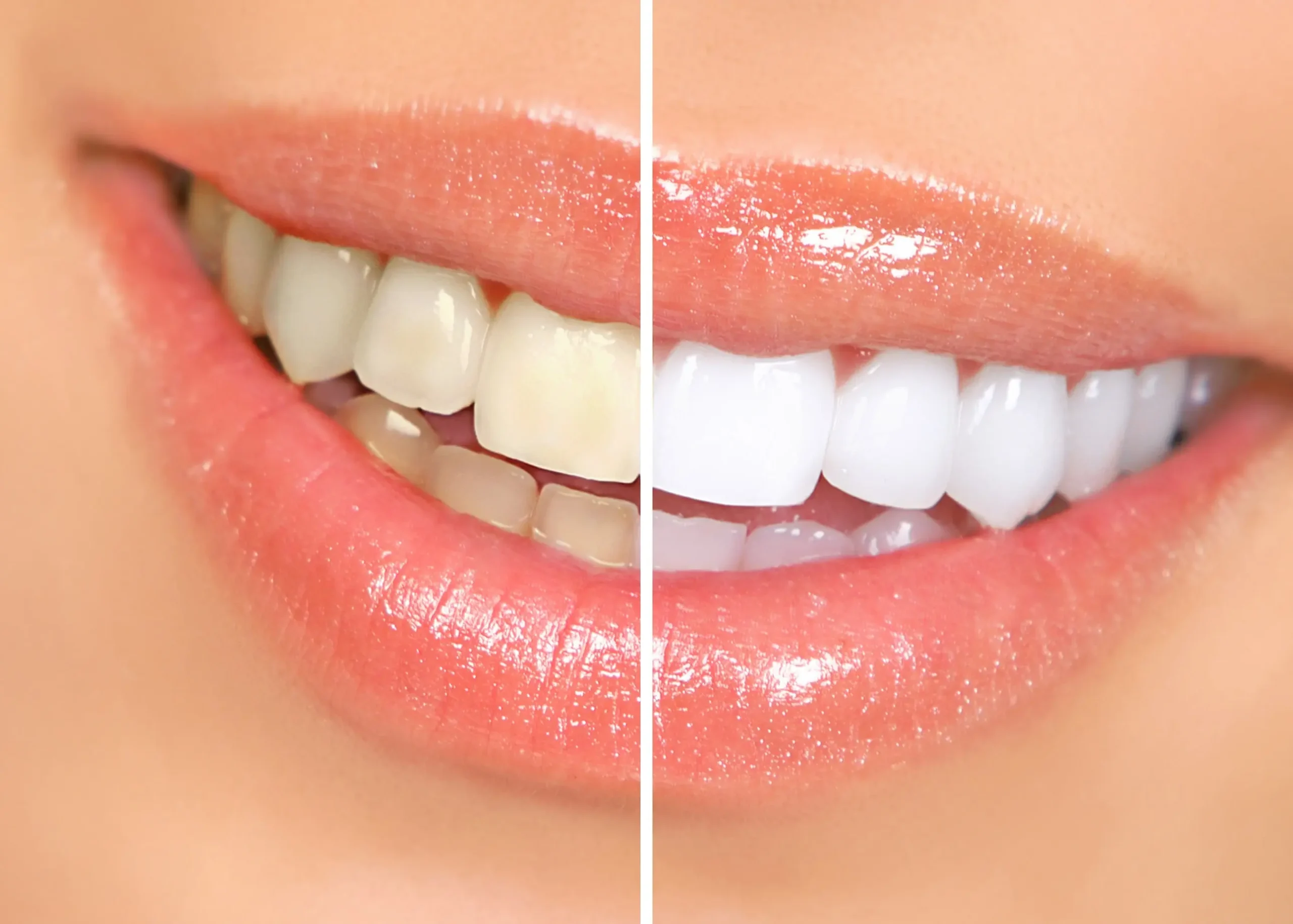 A comparison of yellow and white teeth side by side.